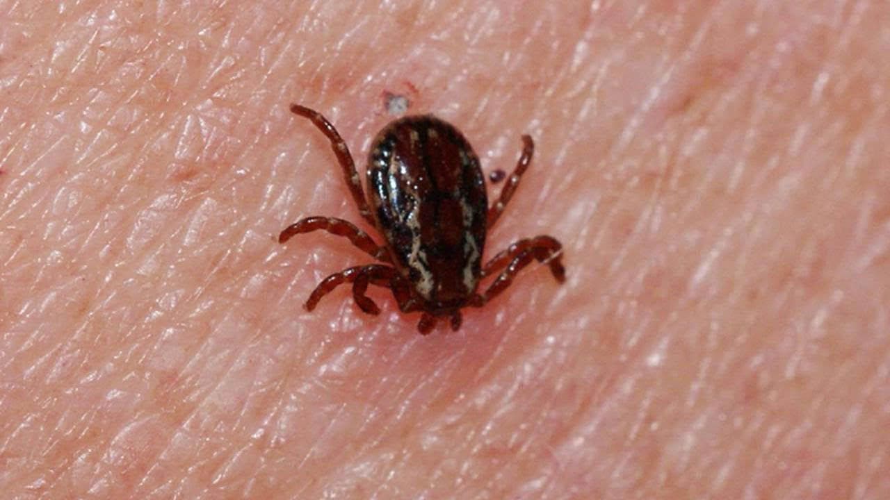 Hayati KKKA uyarısı: Kene müdahalesinde bunları yapmayın