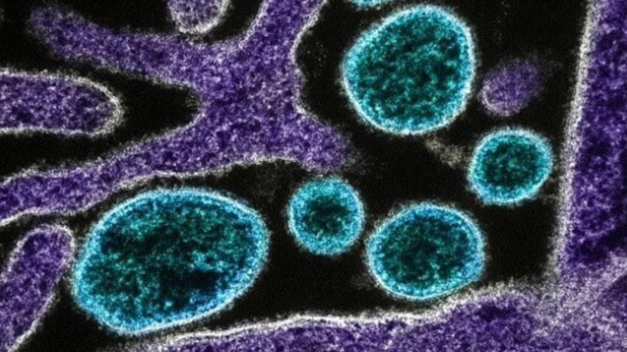 8 yaşındaki kız çocuğu nadir görülen beyin yiyen amip nedeniyle hayatını kaybetti